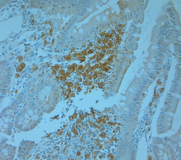 TANK Antibody in Immunohistochemistry (Paraffin) (IHC (P))