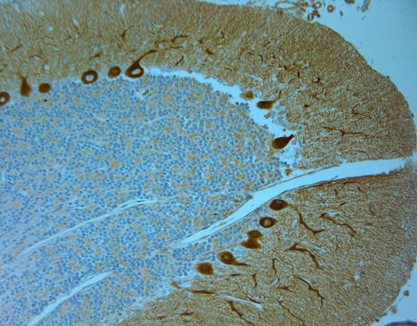 IP3R 1 Antibody in Immunohistochemistry (Paraffin) (IHC (P))