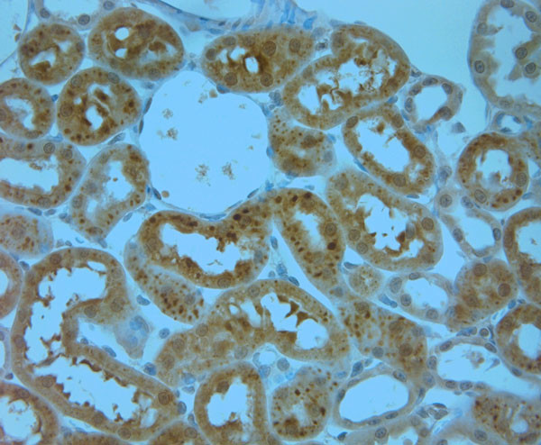 IP3R 1 Antibody in Immunohistochemistry (Paraffin) (IHC (P))