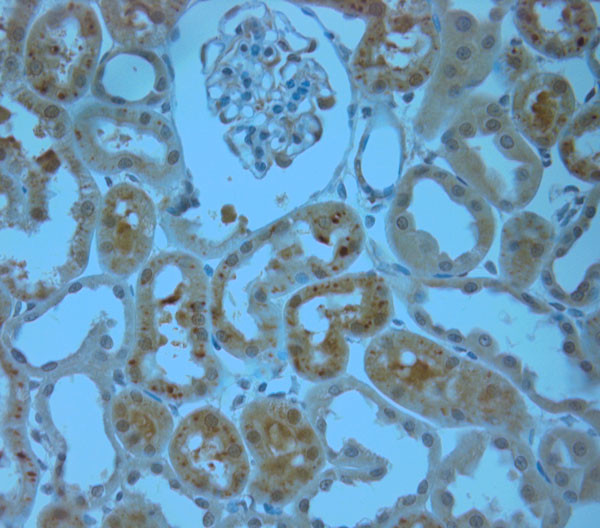 IP3R 1 Antibody in Immunohistochemistry (Paraffin) (IHC (P))