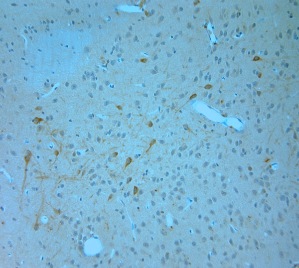 IP3R 1 Antibody in Immunohistochemistry (Paraffin) (IHC (P))