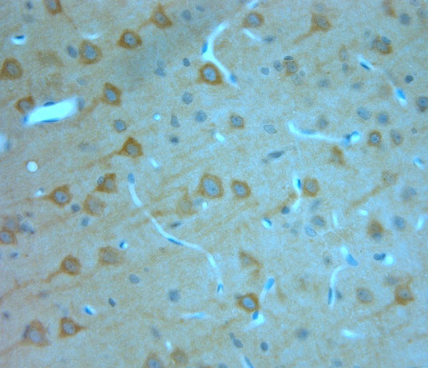 IP3R 1 Antibody in Immunohistochemistry (Paraffin) (IHC (P))