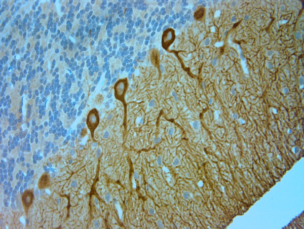 IP3R 1 Antibody in Immunohistochemistry (Paraffin) (IHC (P))