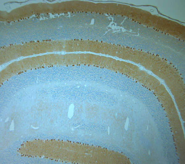 IP3R 1 Antibody in Immunohistochemistry (Paraffin) (IHC (P))