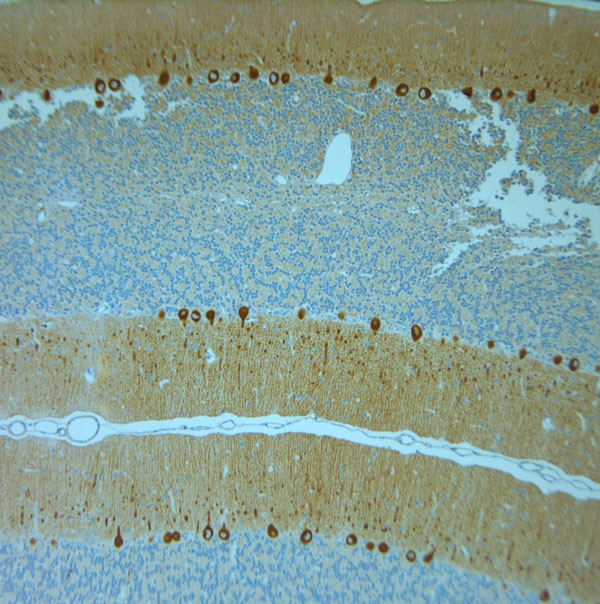 IP3R 1 Antibody in Immunohistochemistry (Paraffin) (IHC (P))