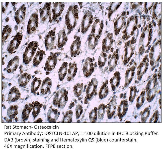 Osteocalcin Antibody in Immunohistochemistry (IHC)