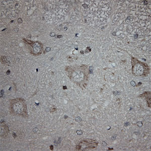 ULK1 Antibody in Immunohistochemistry (Paraffin) (IHC (P))