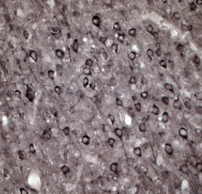 VAMP A/B Antibody in Immunohistochemistry - Free Floating (IHC (Free))