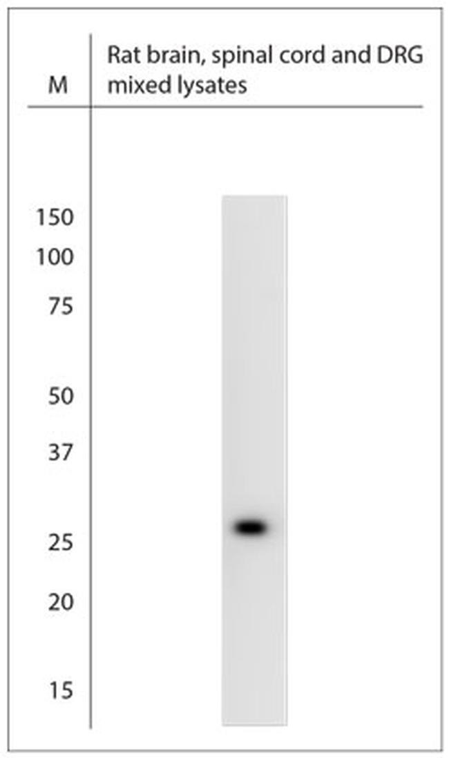 VAMP A/B Antibody in Western Blot (WB)