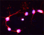 VP33B Antibody in Immunocytochemistry (ICC/IF)