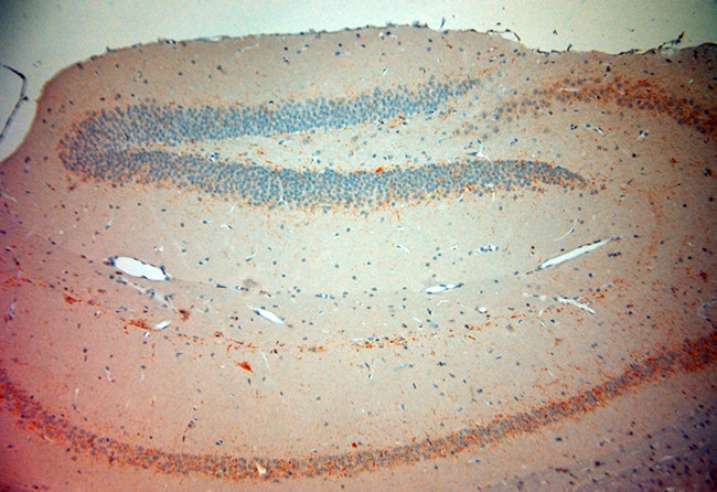 VGluT3 Antibody in Immunohistochemistry (Paraffin) (IHC (P))