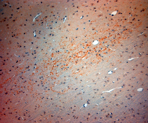 VGluT3 Antibody in Immunohistochemistry (Paraffin) (IHC (P))