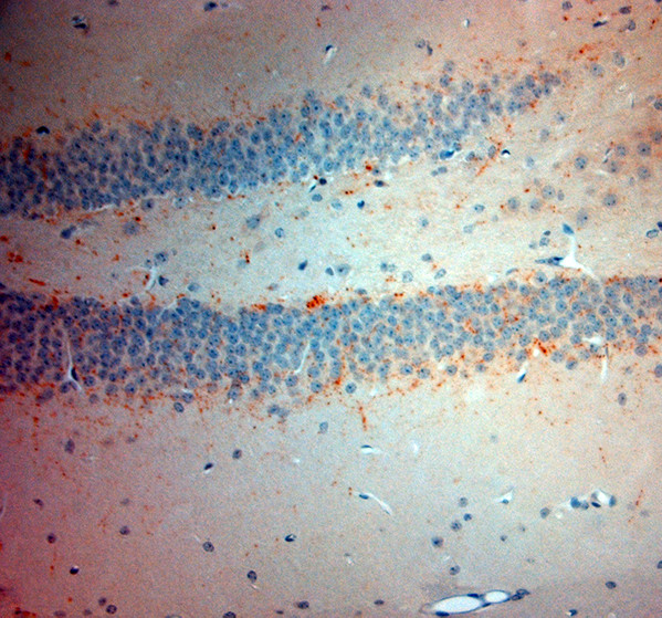 VGluT3 Antibody in Immunohistochemistry (Paraffin) (IHC (P))