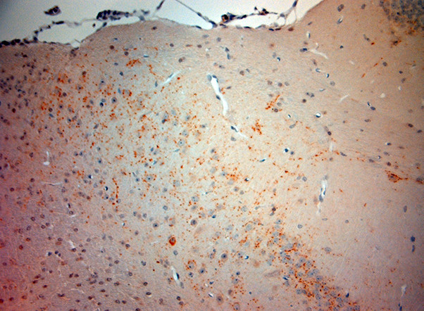 VGluT3 Antibody in Immunohistochemistry (Paraffin) (IHC (P))