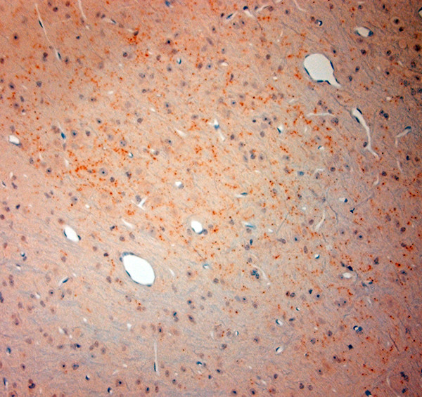 VGluT3 Antibody in Immunohistochemistry (Paraffin) (IHC (P))