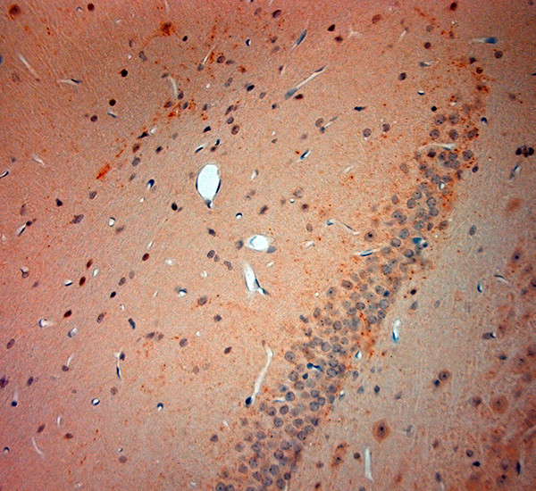 VGluT3 Antibody in Immunohistochemistry (Paraffin) (IHC (P))