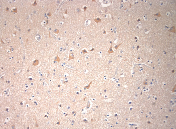 VTI1B Antibody in Immunohistochemistry (Paraffin) (IHC (P))