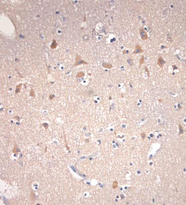 VTI1B Antibody in Immunohistochemistry (Paraffin) (IHC (P))