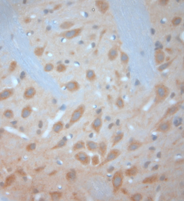 VTI1B Antibody in Immunohistochemistry (Paraffin) (IHC (P))