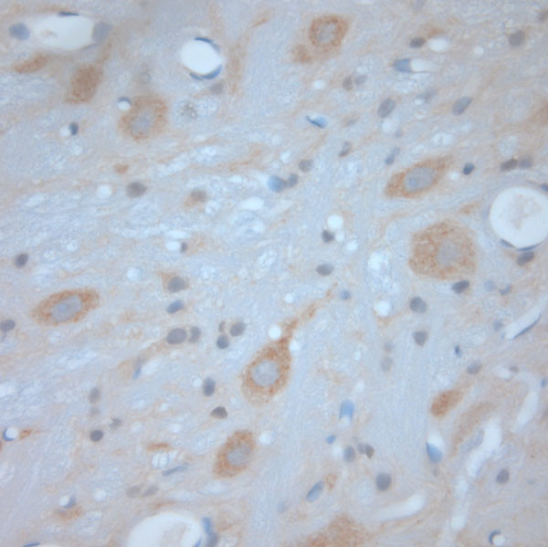 VTI1B Antibody in Immunohistochemistry (Paraffin) (IHC (P))