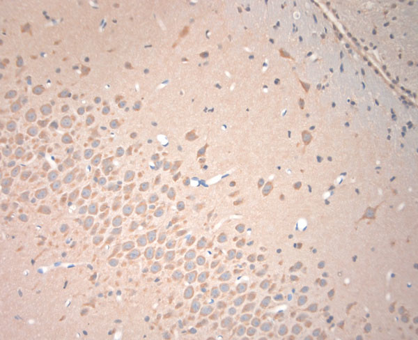 VTI1B Antibody in Immunohistochemistry (Paraffin) (IHC (P))