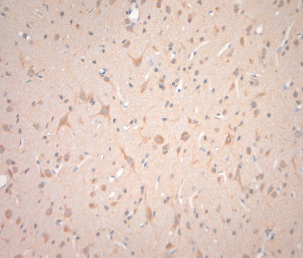 VTI1B Antibody in Immunohistochemistry (Paraffin) (IHC (P))