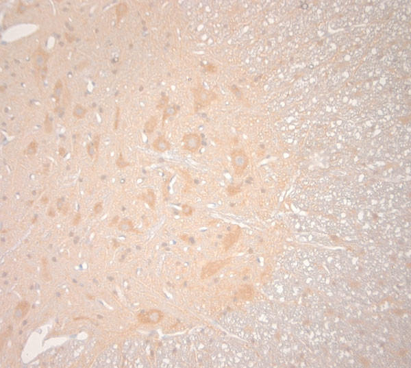 VTI1B Antibody in Immunohistochemistry (Paraffin) (IHC (P))