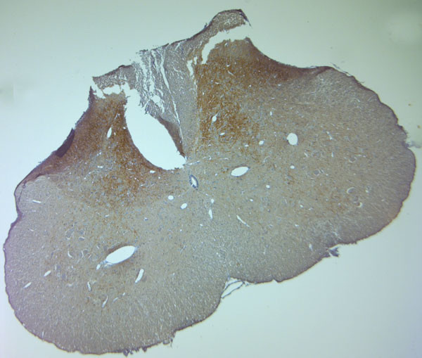 VGluT1 Antibody in Immunohistochemistry (Paraffin) (IHC (P))