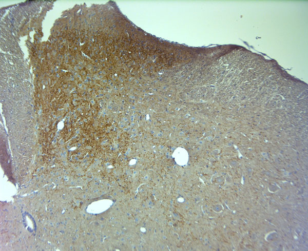 VGluT1 Antibody in Immunohistochemistry (Paraffin) (IHC (P))