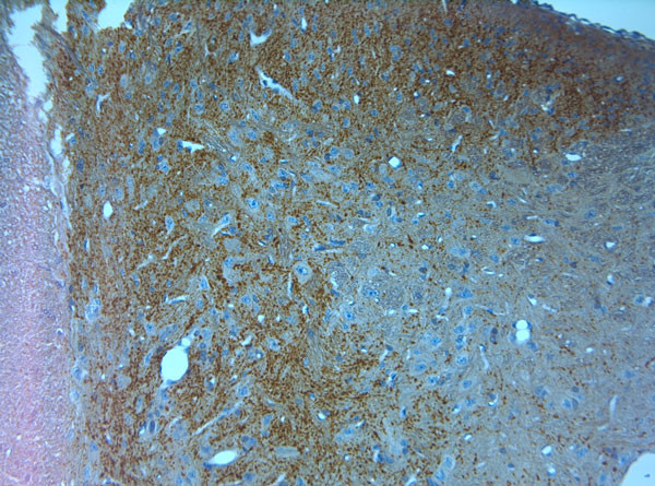 VGluT1 Antibody in Immunohistochemistry (Paraffin) (IHC (P))