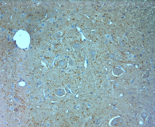 VGluT1 Antibody in Immunohistochemistry (Paraffin) (IHC (P))