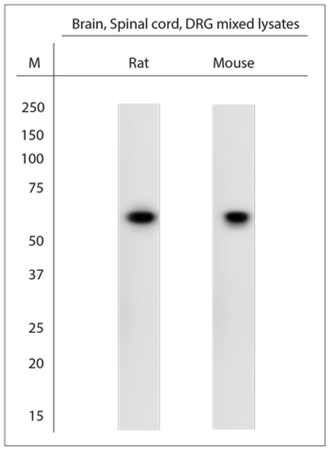 VGluT1 Antibody in Western Blot (WB)