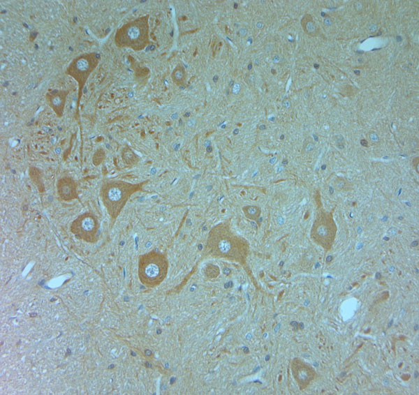 VPS34 Antibody in Immunohistochemistry (Paraffin) (IHC (P))