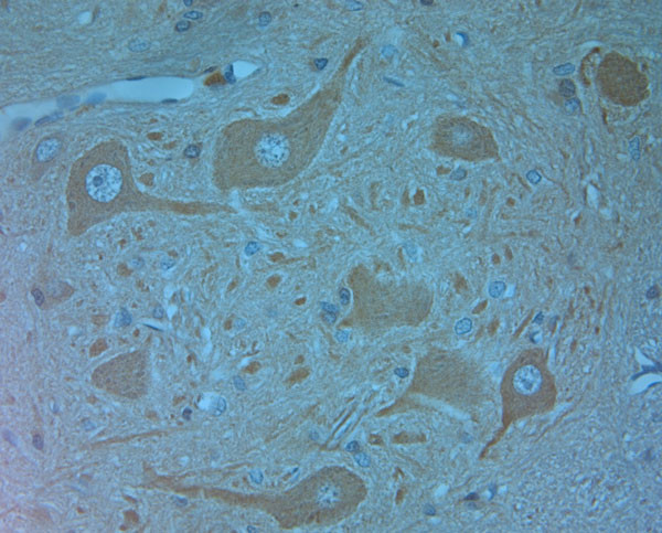 VPS34 Antibody in Immunohistochemistry (Paraffin) (IHC (P))