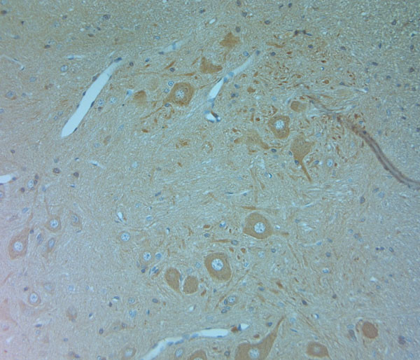 VPS34 Antibody in Immunohistochemistry (Paraffin) (IHC (P))