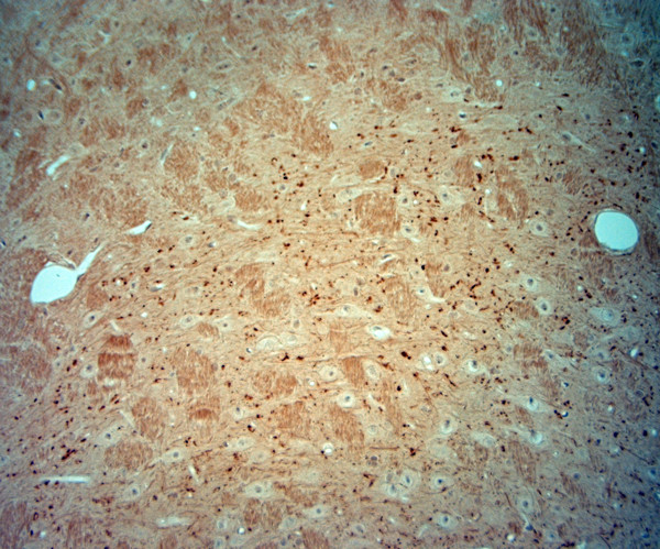 VGluT2 Antibody in Immunohistochemistry (Paraffin) (IHC (P))