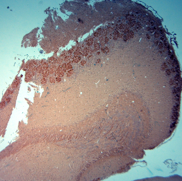 VGluT2 Antibody in Immunohistochemistry (Paraffin) (IHC (P))