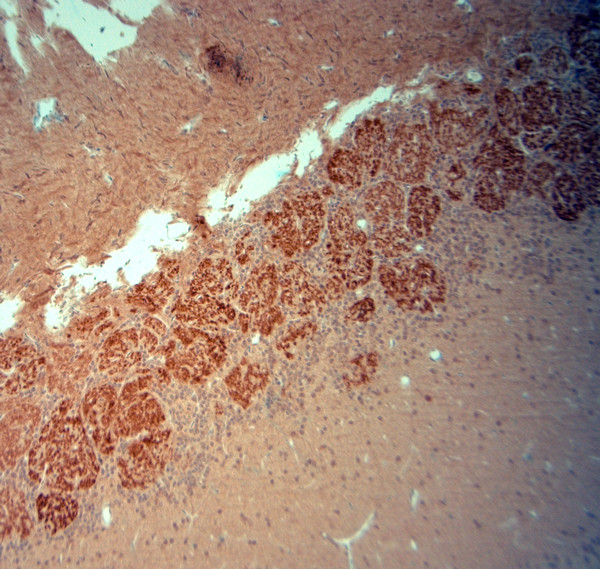 VGluT2 Antibody in Immunohistochemistry (Paraffin) (IHC (P))