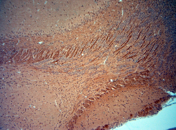 VGluT2 Antibody in Immunohistochemistry (Paraffin) (IHC (P))