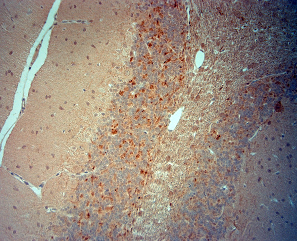 VGluT2 Antibody in Immunohistochemistry (Paraffin) (IHC (P))