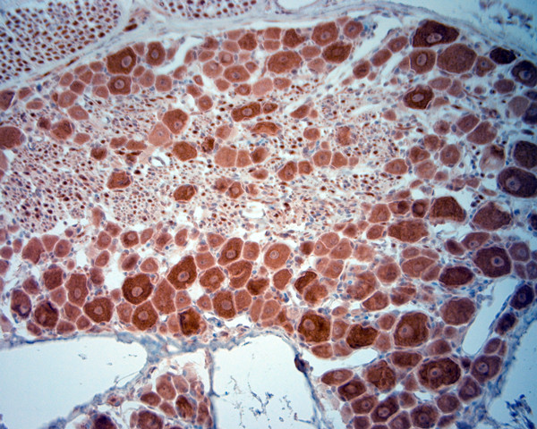 VGluT2 Antibody in Immunohistochemistry (Paraffin) (IHC (P))