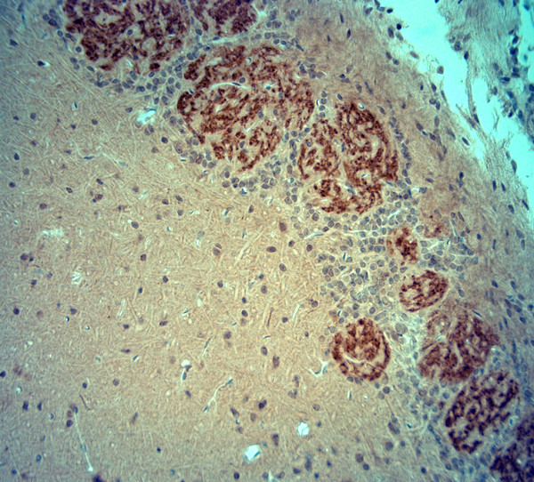 VGluT2 Antibody in Immunohistochemistry (Paraffin) (IHC (P))