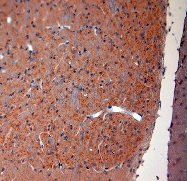 VGluT2 Antibody in Immunohistochemistry (Paraffin) (IHC (P))