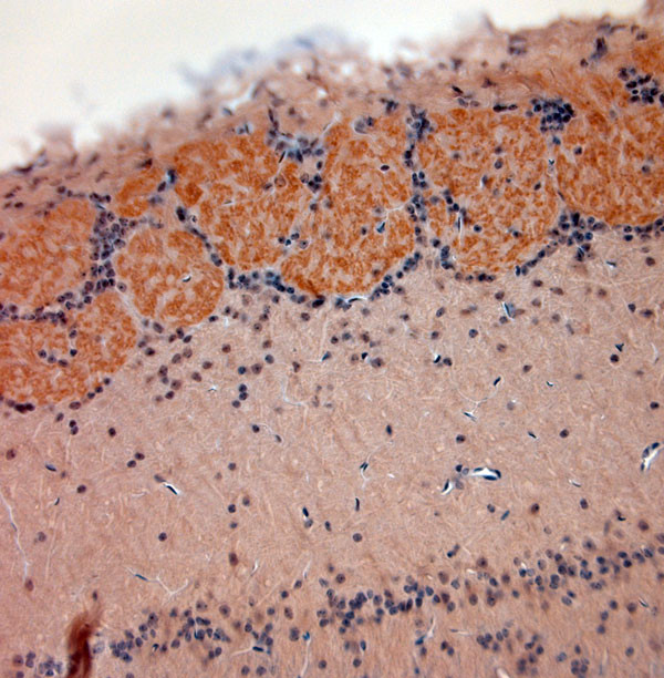 VGluT2 Antibody in Immunohistochemistry (Paraffin) (IHC (P))