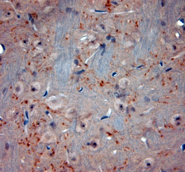 VGluT2 Antibody in Immunohistochemistry (Paraffin) (IHC (P))