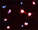 NRIF1 Antibody in Immunocytochemistry (ICC/IF)