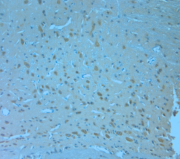 NRIF1 Antibody in Immunohistochemistry (Paraffin) (IHC (P))