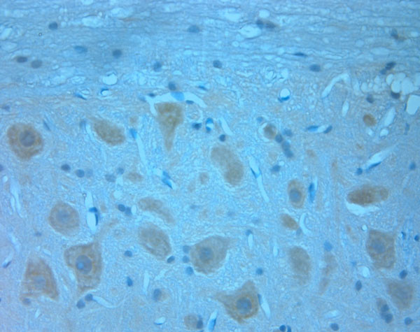 NRIF1 Antibody in Immunohistochemistry (Paraffin) (IHC (P))