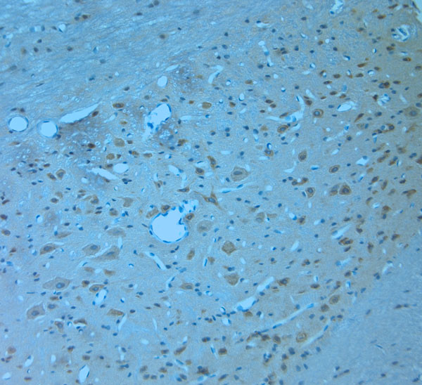 NRIF1 Antibody in Immunohistochemistry (Paraffin) (IHC (P))