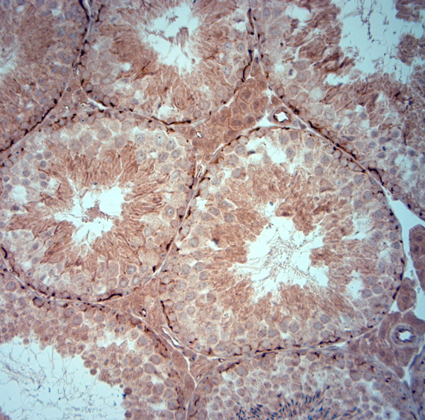 ZO1 Antibody in Immunohistochemistry (Paraffin) (IHC (P))